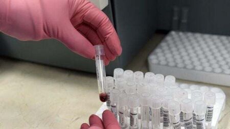 Number of people living with HIV in Ireland increases to 100 cases per month