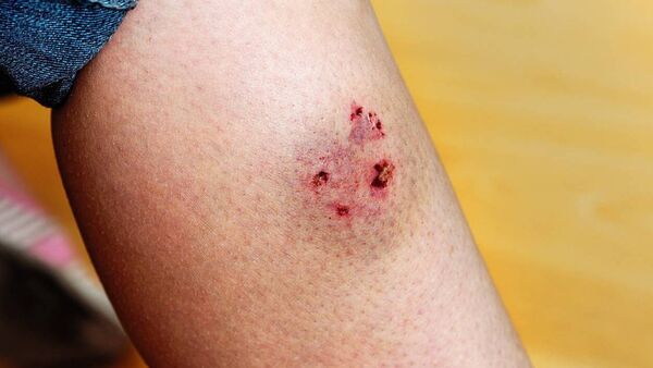 Roscommon records one of the highest incidence of dog bites in the country