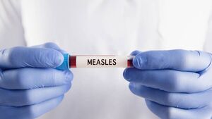 Measles case confirmed in Mayo