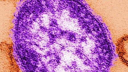 Passengers on Dublin to Tipperary bus exposed to measles