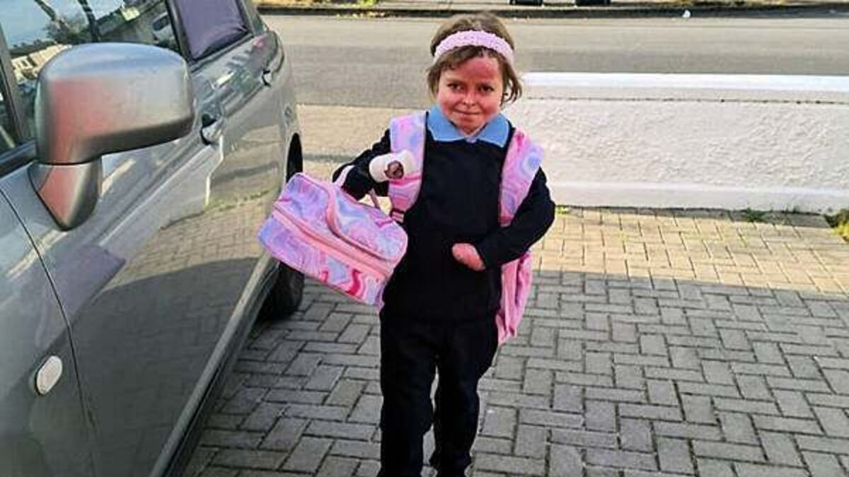 Girl with rare skin disease excited to go to secondary school