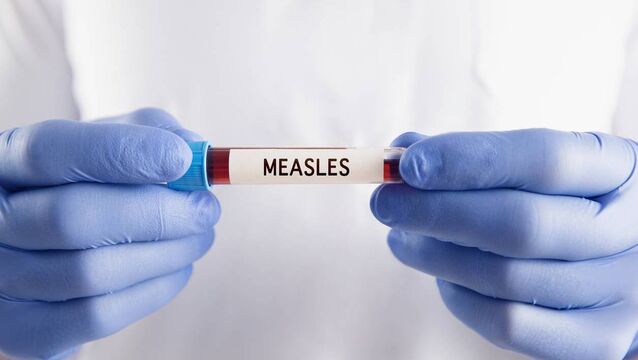 <p>The Health Service Executive has this evening said that a highly suspect measles case has been notified to the Department of Public Health, HSE West and North West and is currently under investigation.</p>