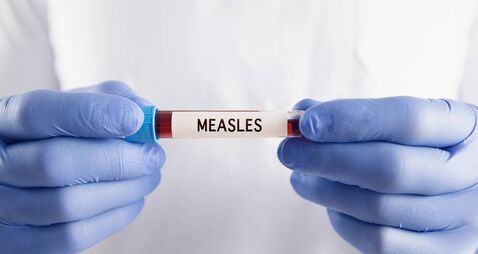 HSE warns about suspected measles on train through County Roscommon