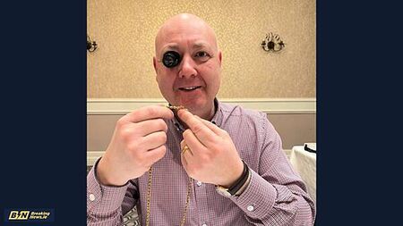 Gold teeth complete with roots sold as people cash jewellery in