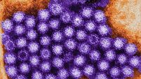 Norovirus cases up over 50 per cent in a week – HSE