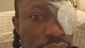Gardaí investigating after Limerick hip hop artist partially blinded in road rage attack