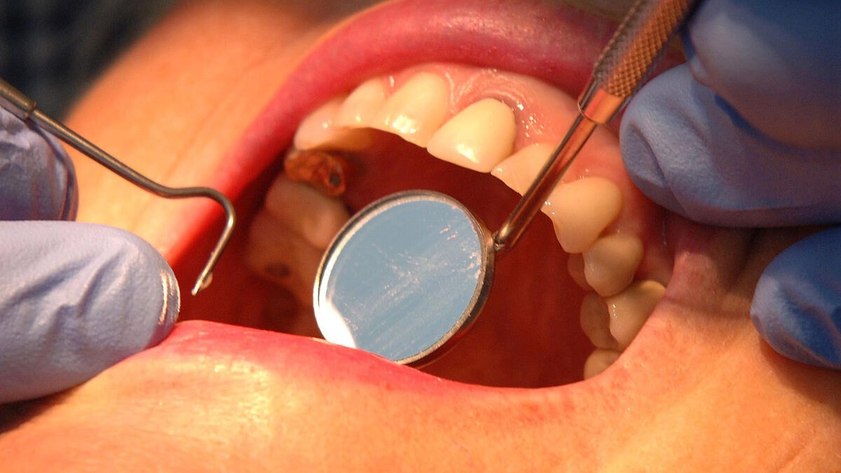 Urgent reform of dental care needed says Kerrane
