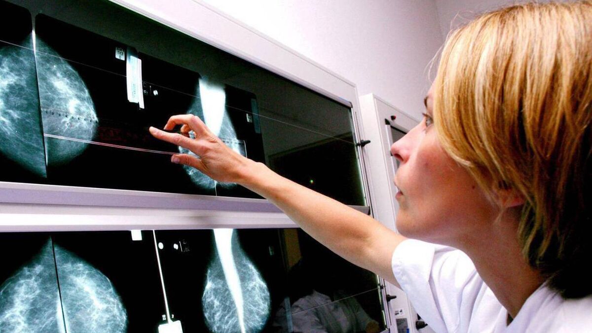 Improvements to local breast cancer services welcomed
