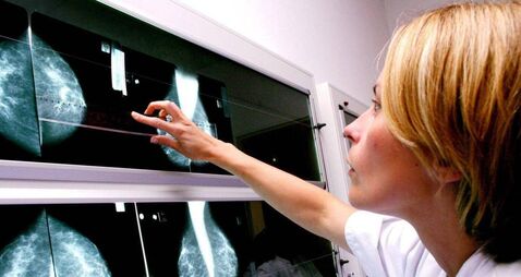 Improvements to local breast cancer services welcomed 