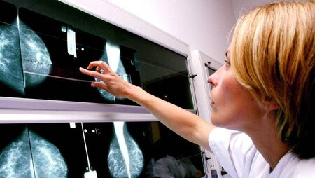 Improvements to local breast cancer services welcomed 